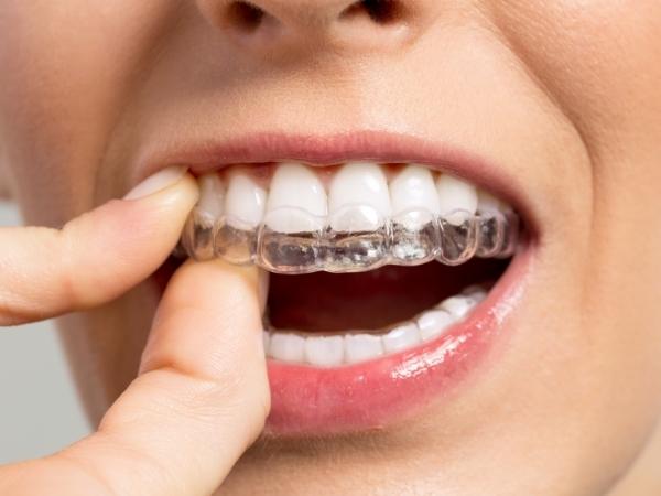 invisalign near me mill hill north london